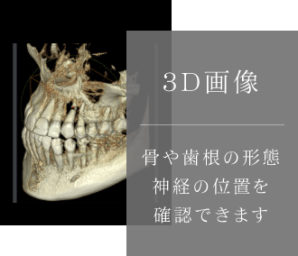 3D画像 骨や歯根の形態神経の位置を確認できます