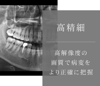 高精細 高解像度の画質で病変をより正確に把握