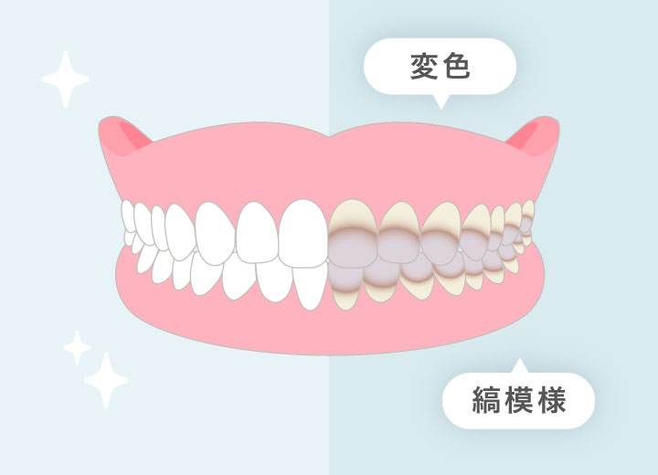 変色、縞模様