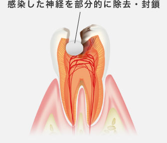 GDS 総義歯の真髄 | 松本 勝利 |本 | 通販 | Amazon