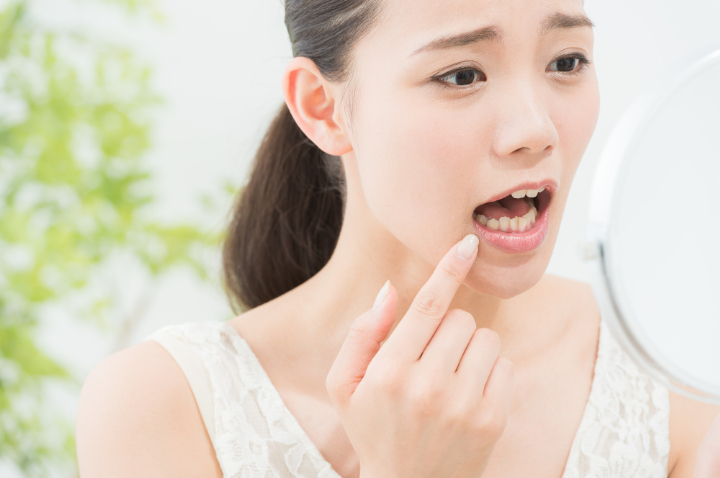 虫歯ができて気にする女性