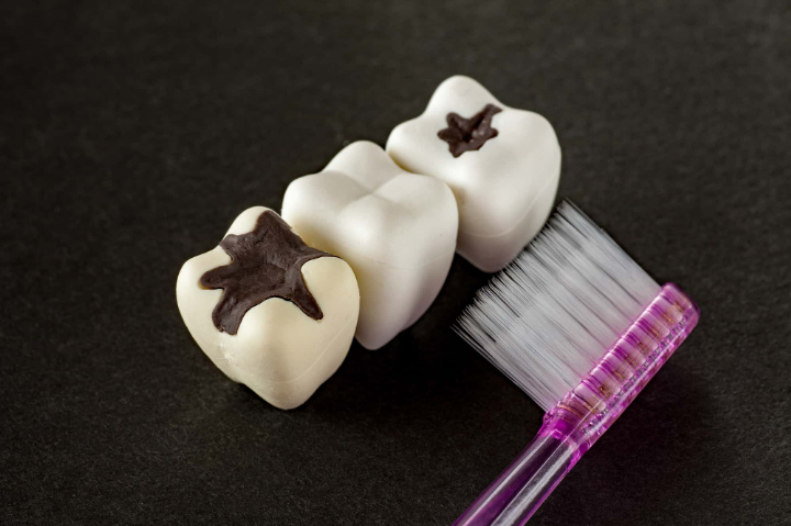 歯ブラシが届きにくく虫歯になった奥歯のイメージ
