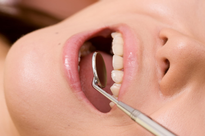 虫歯予防で定期歯科検診を受けるイメージ